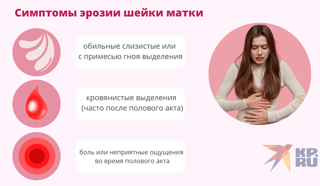 Симптомы эрозии шейки матки