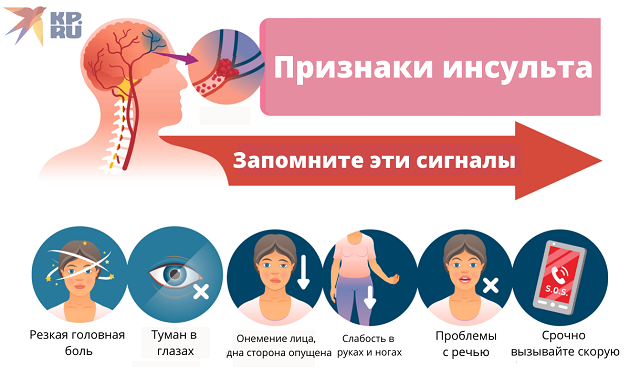 Признаки инсульта