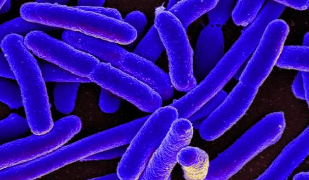 Кишечная палочка