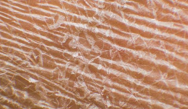 Кожа человека