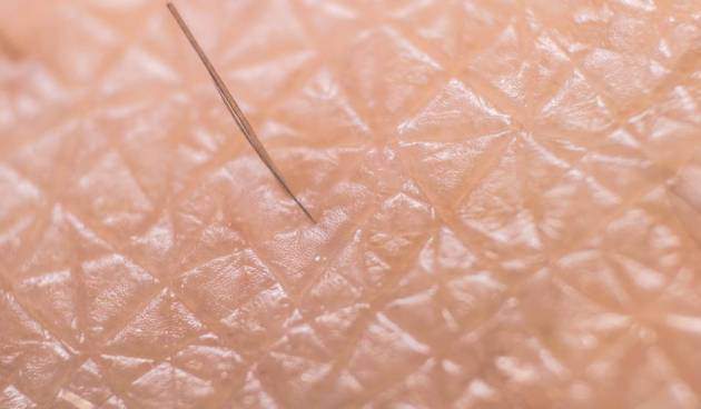 Кожа человека