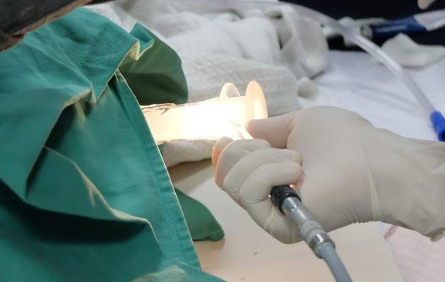 Хирургическое вмешательство при геморрое