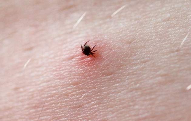 Укус клеща у человека