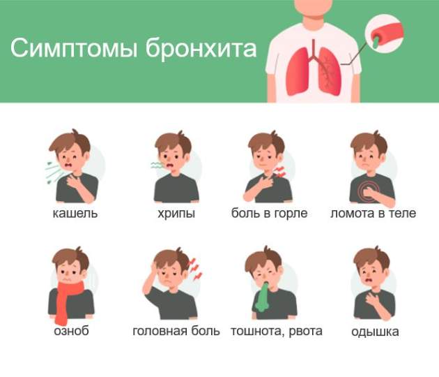 Симптомы бронхита у взрослых