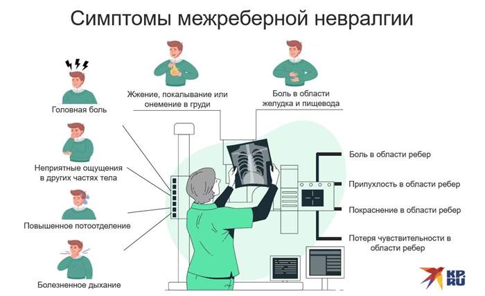Проявления межреберной невралгии