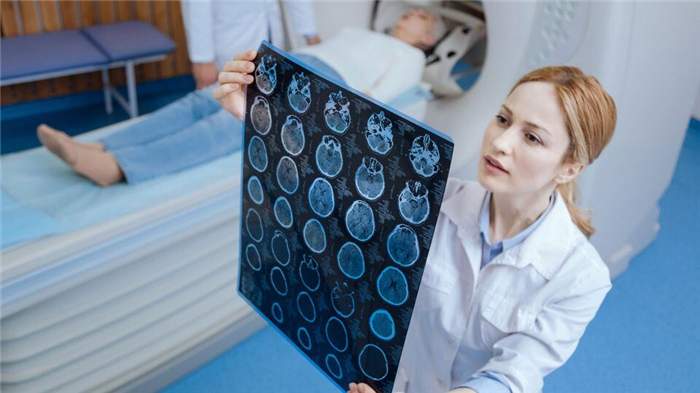 Киста головного мозга у взрослых. Фото: Shutterstock