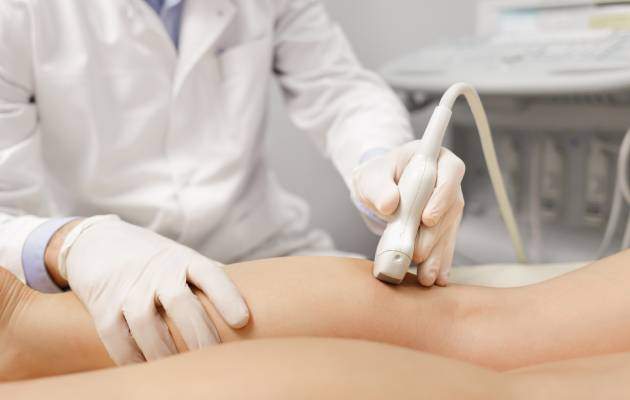 Вены нижних конечностей человека