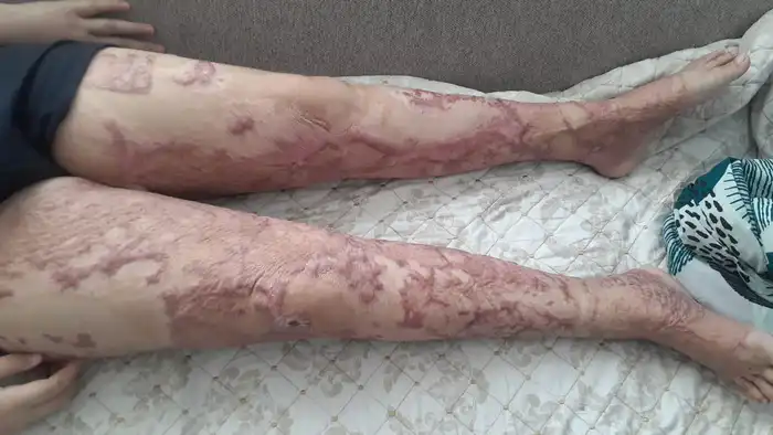 Состояние нижней половины тела